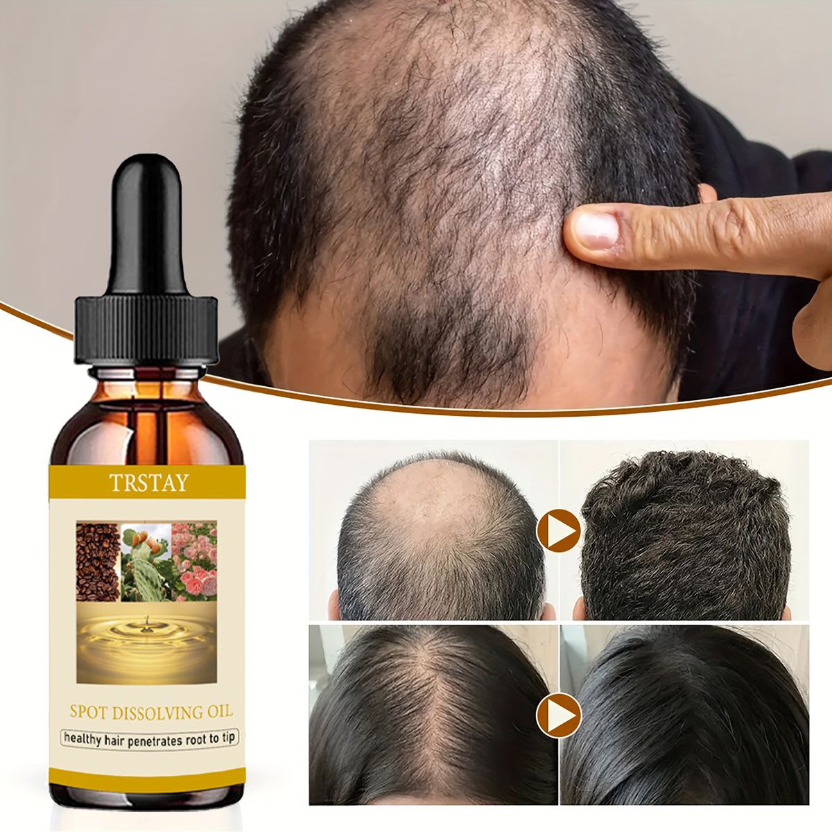 50ML huile de croissance de ba - Beard Oil avis et prix